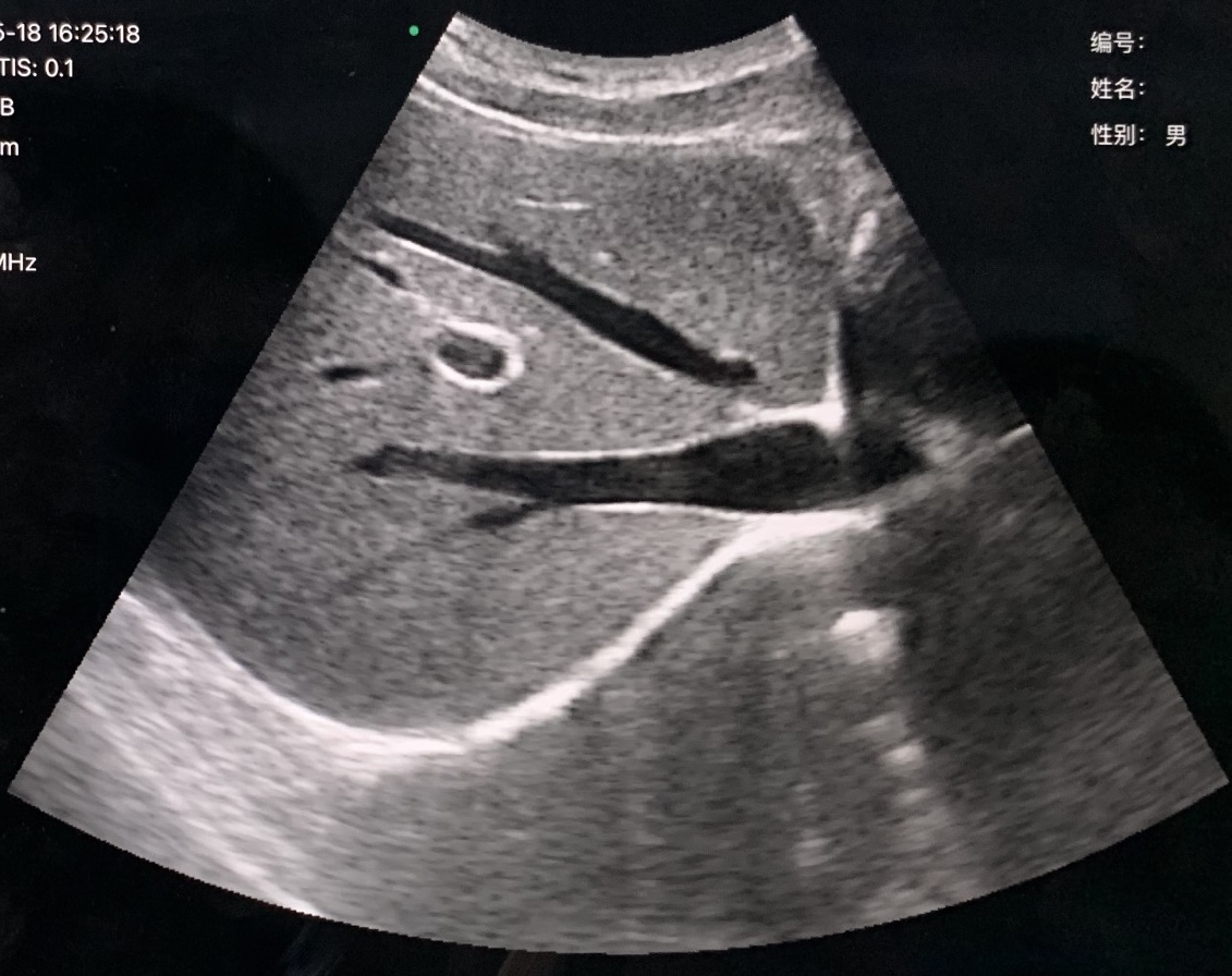 Clinical Image 2