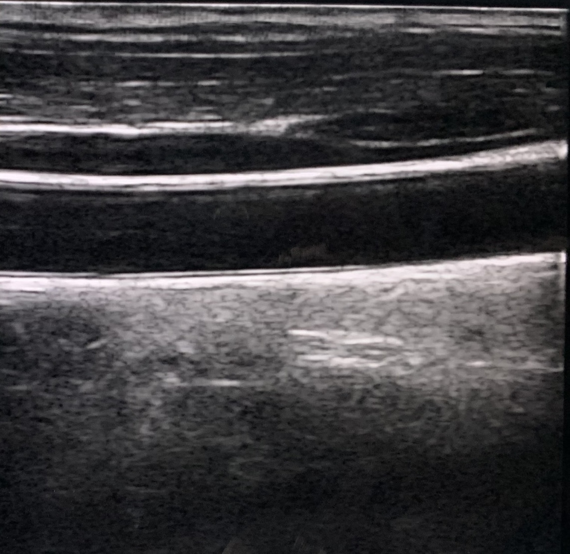 Clinical Image 6