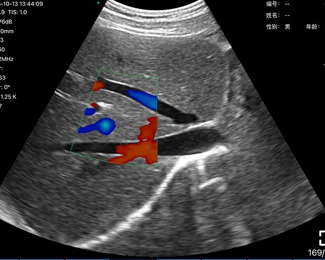 Clinical Image 1