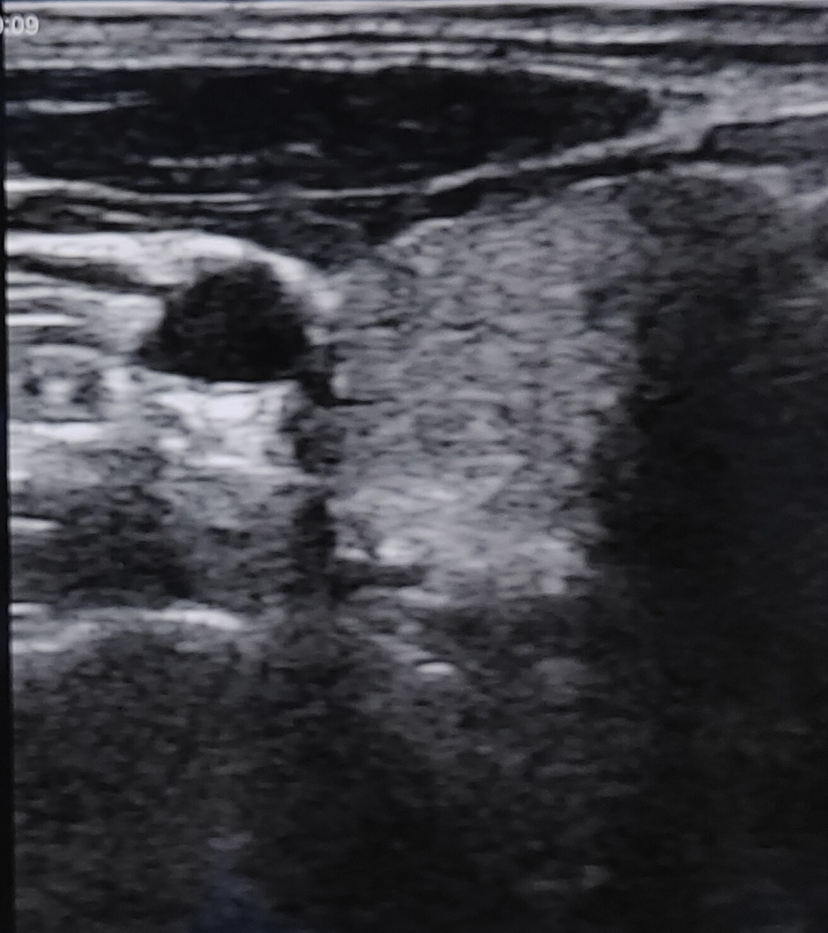 Clinical Image 7
