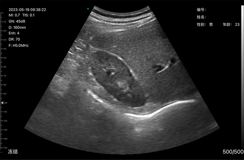 Clinical Image 5