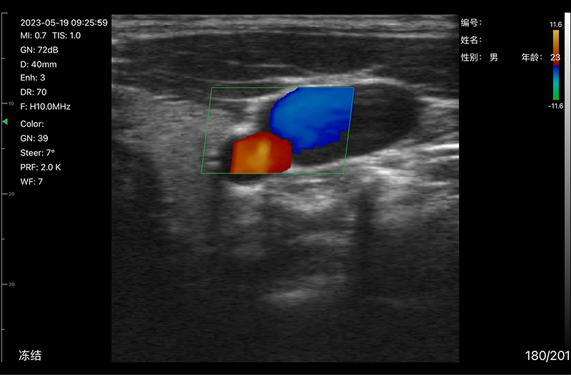 Clinical Image 4