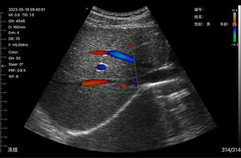 Clinical Image 3