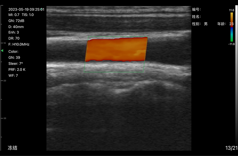 Clinical Image 2