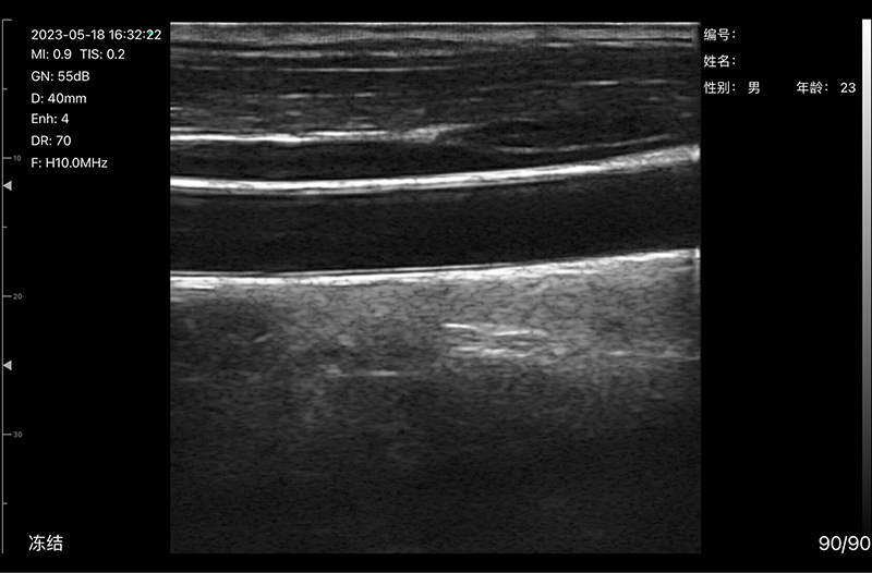 Clinical Image 1