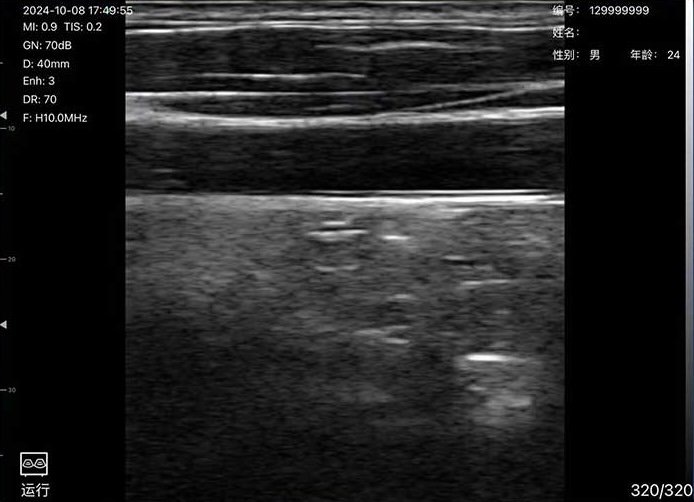 Clinical Image 3