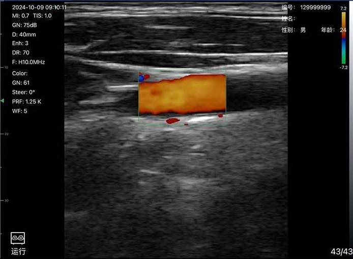 Clinical Image 2