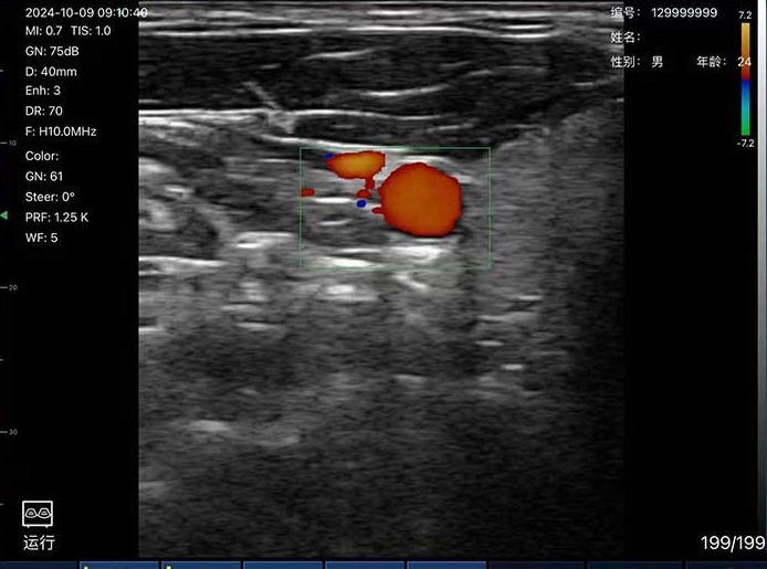 Clinical Image 1